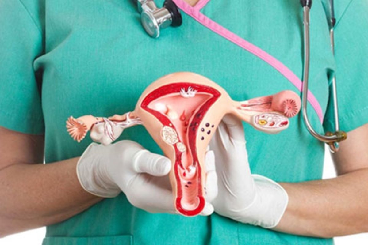 hysterectomy img
