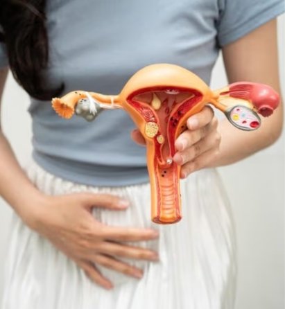 Adenomyosis causes and risk factor