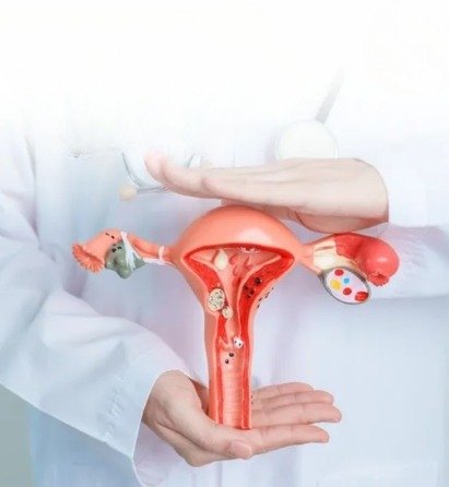 Ovarian Cysts Treatment options